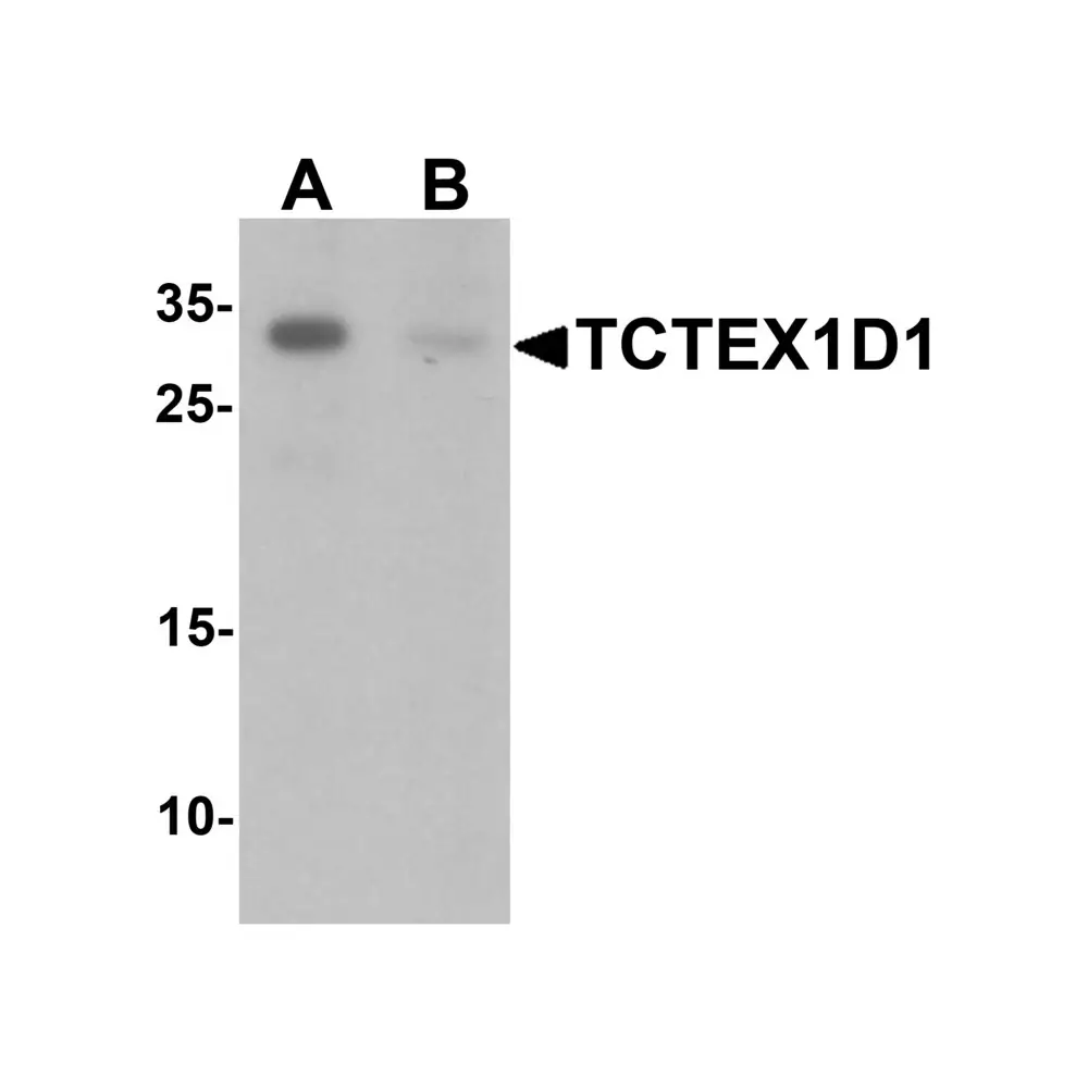 ProSci 6951_S TCTEX1D1 Antibody, ProSci, 0.02 mg/Unit Primary Image