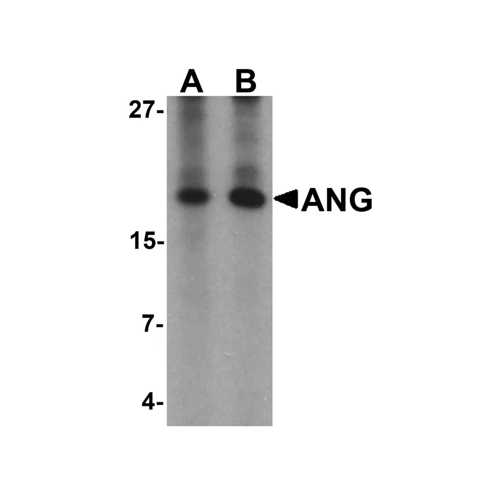 ProSci 6983 ANG Antibody, ProSci, 0.1 mg/Unit Primary Image