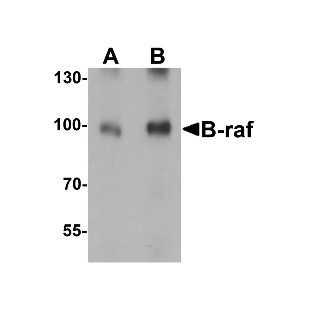 ProSci 7379_S B-raf Antibody, ProSci, 0.02 mg/Unit Primary Image