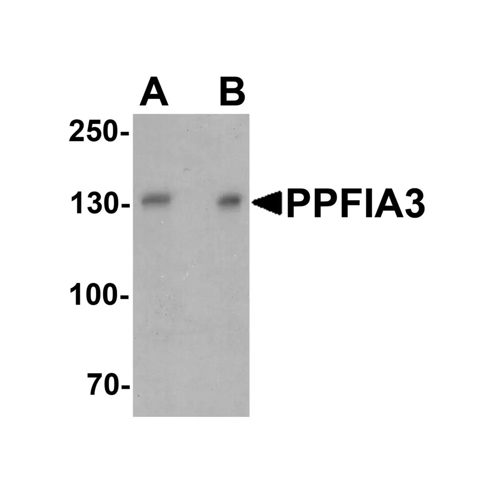 ProSci 7561_S PPFIA3 Antibody, ProSci, 0.02 mg/Unit Primary Image