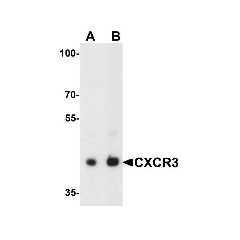 ProSci 7647 CXCR3 Antibody, ProSci, 0.1 mg/Unit Primary Image