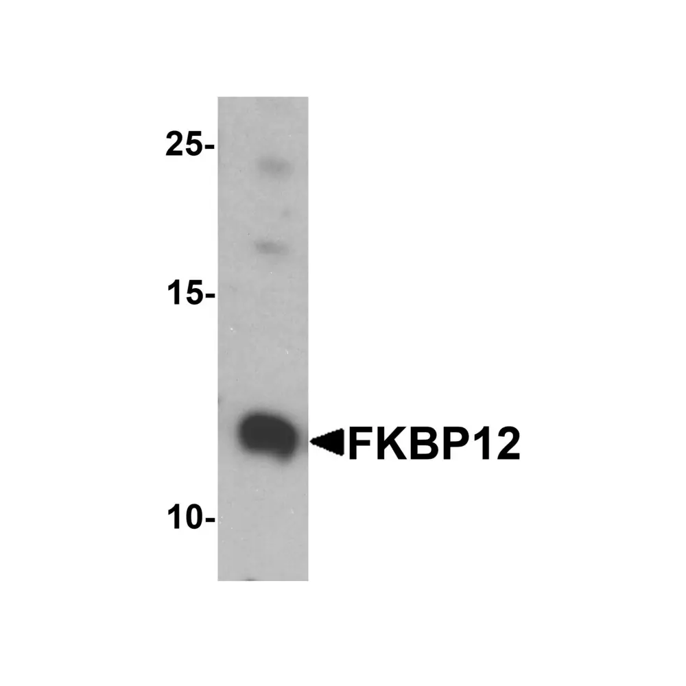 ProSci 7789 FKBP12 Antibody, ProSci, 0.1 mg/Unit Primary Image