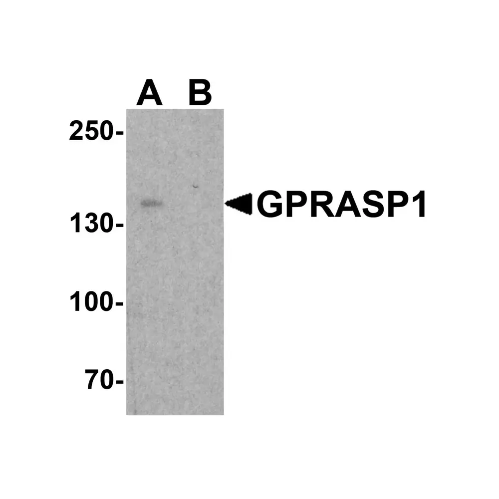 ProSci 7989_S Beclin 2 Antibody, ProSci, 0.02 mg/Unit Primary Image