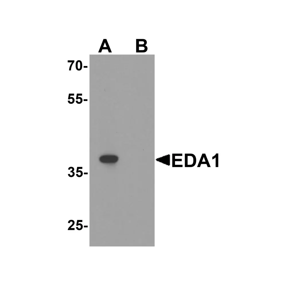 ProSci 8045 EDA1 Antibody, ProSci, 0.1 mg/Unit Primary Image