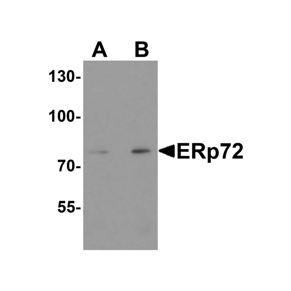 ProSci 8211_S ERp72 Antibody, ProSci, 0.02 mg/Unit Primary Image