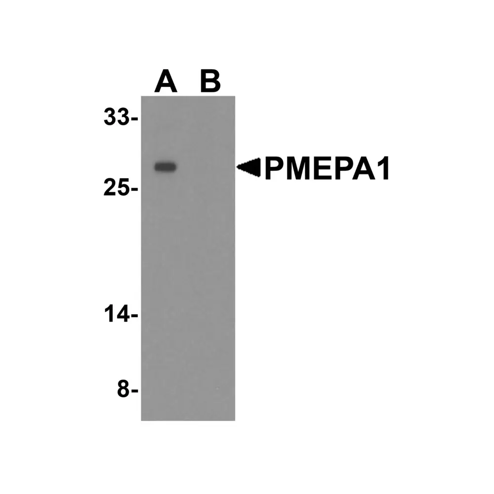 ProSci 8261 PMEPA1 Antibody, ProSci, 0.1 mg/Unit Primary Image