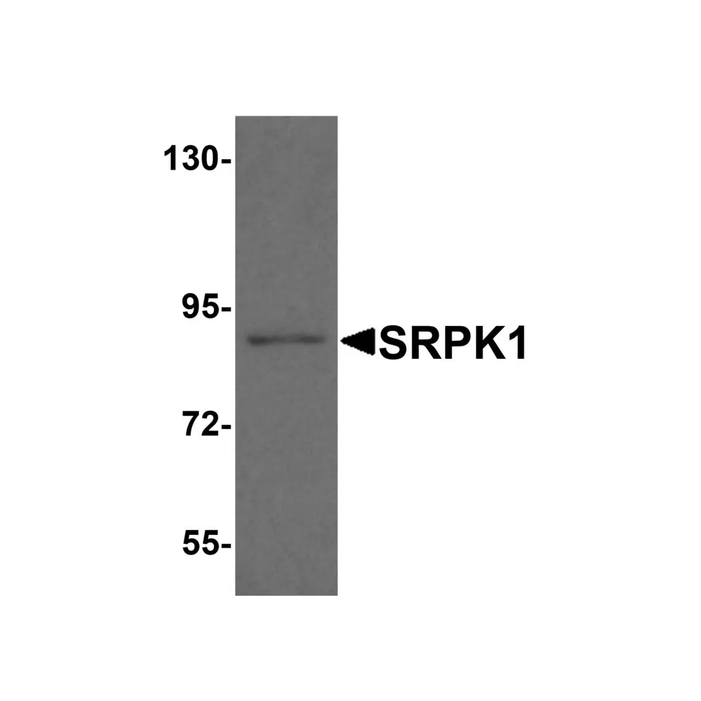 ProSci 8435 SRPK1 Antibody, ProSci, 0.1 mg/Unit Primary Image