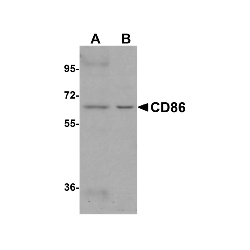 ProSci 8681_S CD86 Antibody, ProSci, 0.02 mg/Unit Primary Image