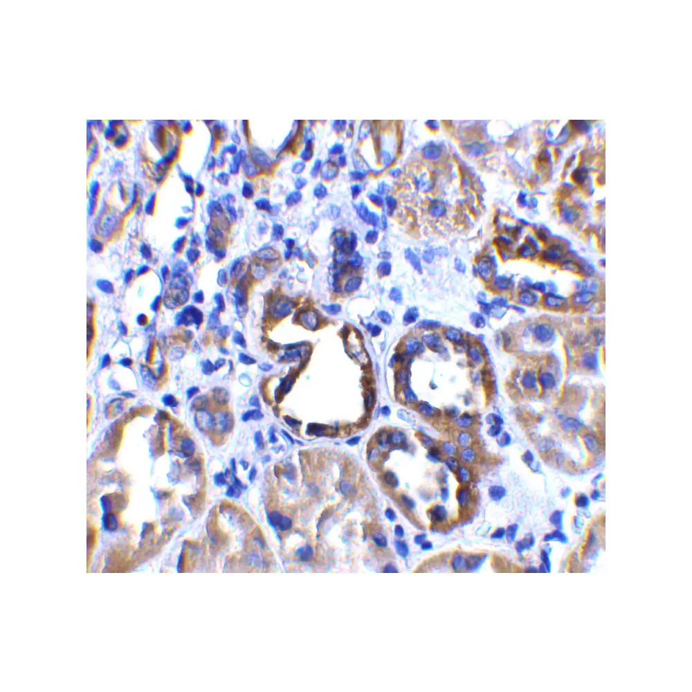 ProSci 3229_S ACE2 Antibody, ProSci, 0.02 mg/Unit Quaternary Image