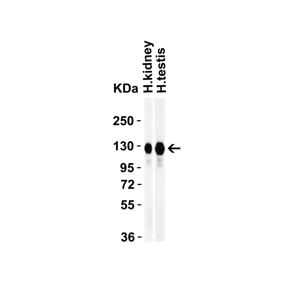 ProSci 3227_S ACE2 Antibody, ProSci, 0.02 mg/Unit Secondary Image