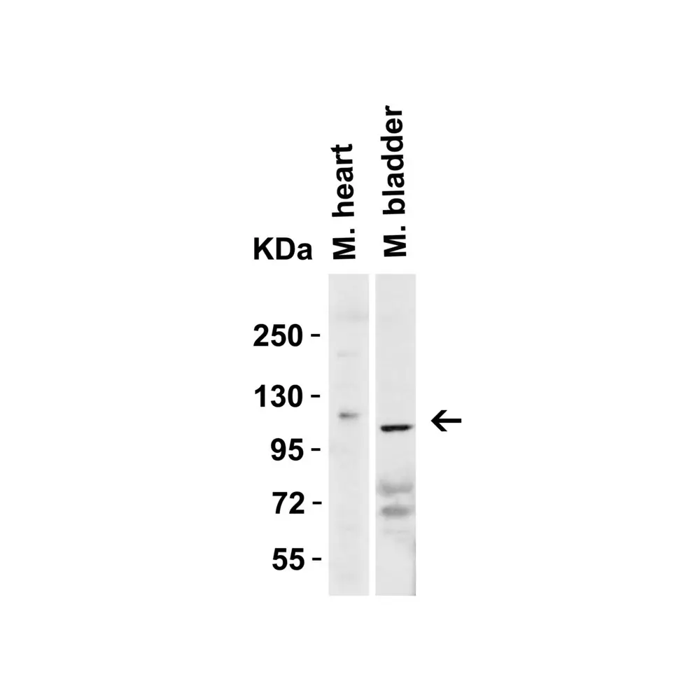 ProSci 3227_S ACE2 Antibody, ProSci, 0.02 mg/Unit Tertiary Image