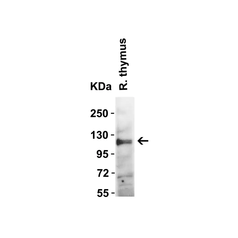 ProSci 3227_S ACE2 Antibody, ProSci, 0.02 mg/Unit Quaternary Image