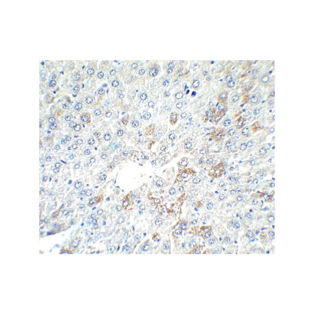 ProSci 5869_S AFP Antibody, ProSci, 0.02 mg/Unit Secondary Image