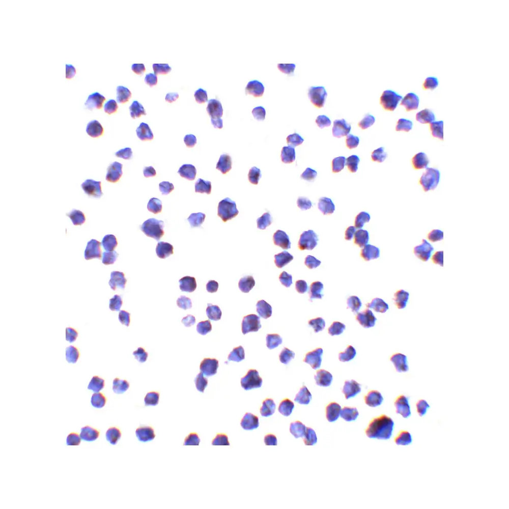 ProSci 8469_S ALSFTD Antibody, ProSci, 0.02 mg/Unit Secondary Image