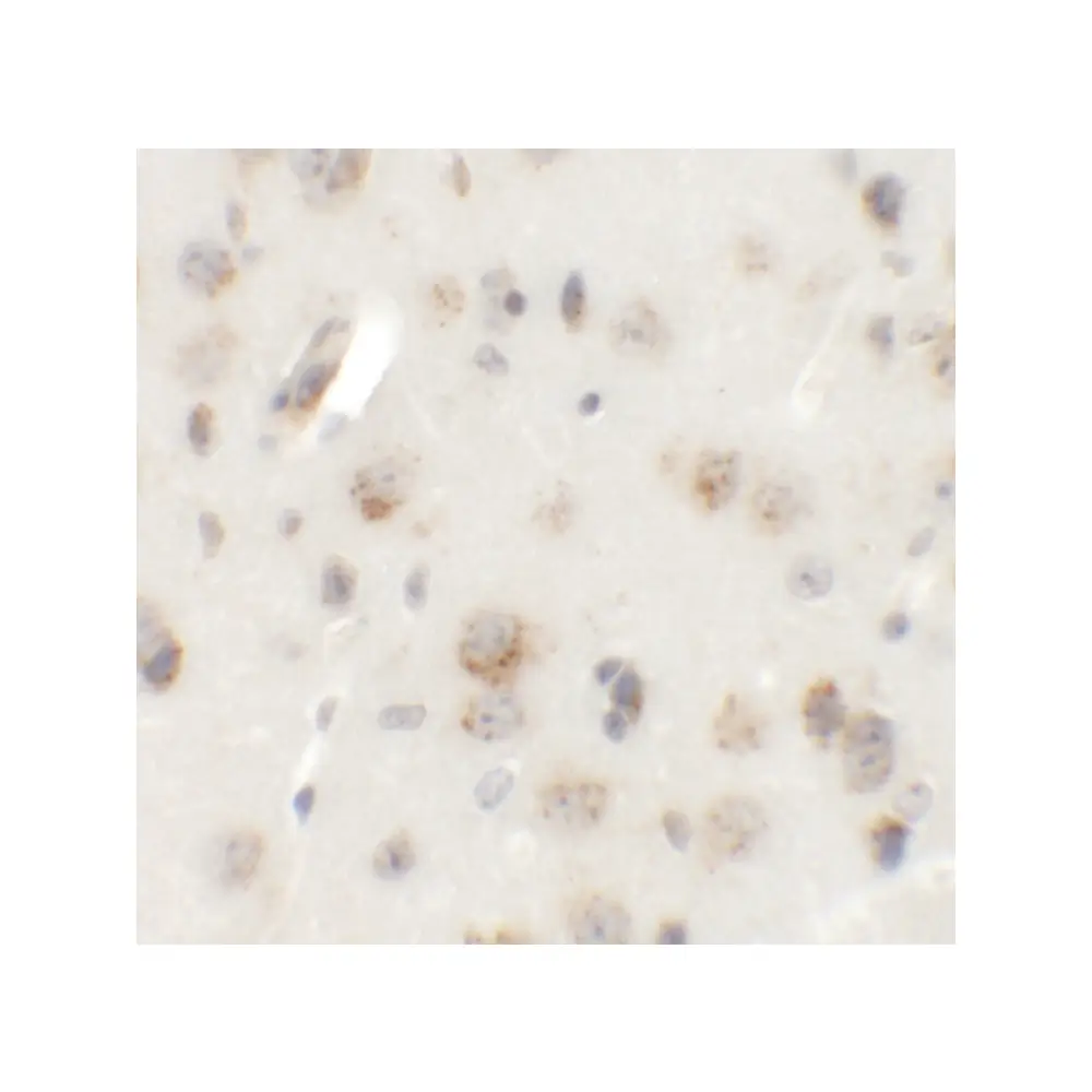 ProSci 6395_S AP3B2 Antibody, ProSci, 0.02 mg/Unit Secondary Image