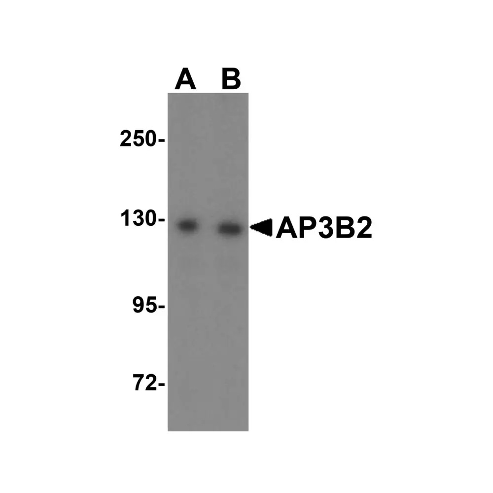 ProSci 6395_S AP3B2 Antibody, ProSci, 0.02 mg/Unit Quaternary Image