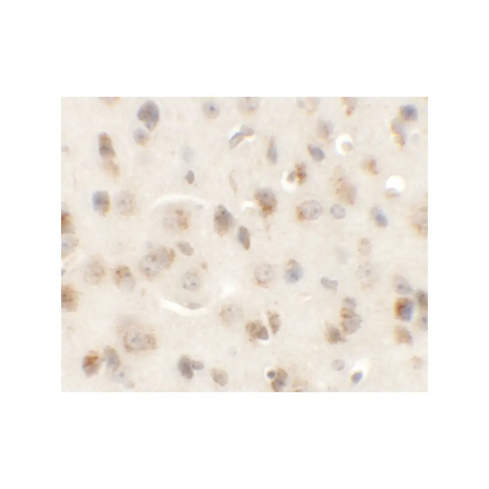 ProSci 6393_S AP3M1 Antibody, ProSci, 0.02 mg/Unit Secondary Image