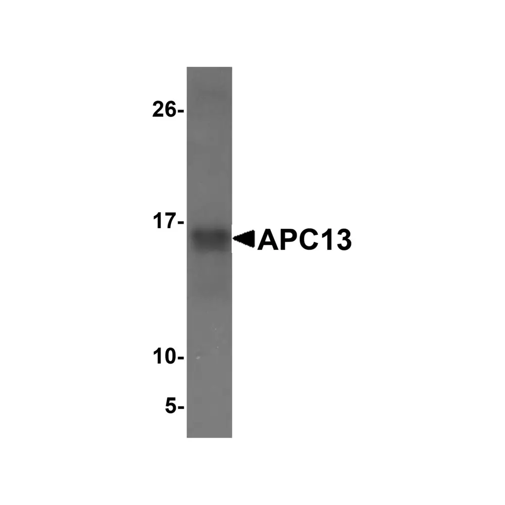 ProSci 5739 APC13 Antibody, ProSci, 0.1 mg/Unit Tertiary Image