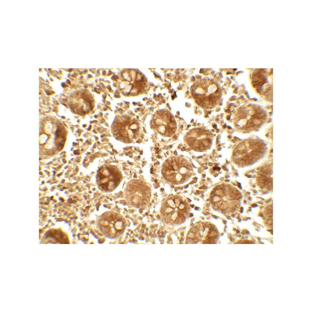 ProSci 7725_S APOBEC3B Antibody, ProSci, 0.02 mg/Unit Secondary Image