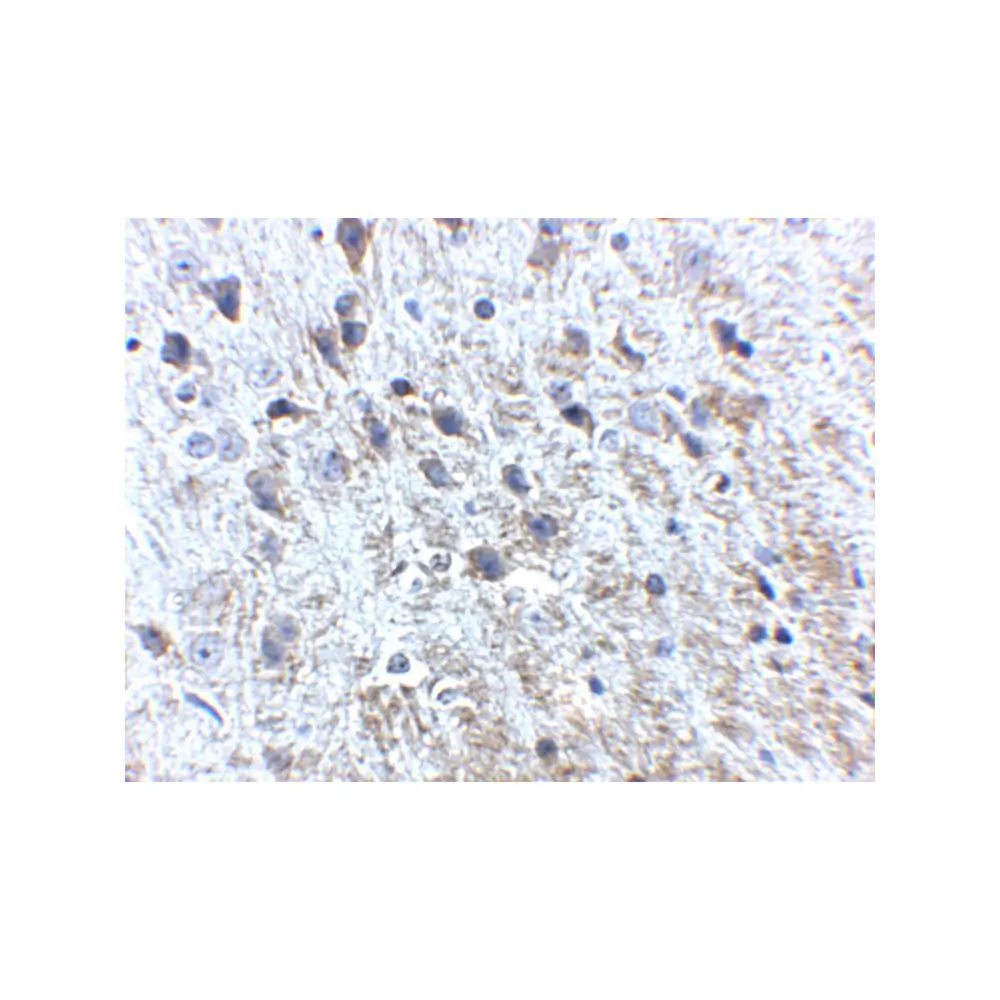 ProSci 5129 APP Antibody, ProSci, 0.1 mg/Unit Secondary Image