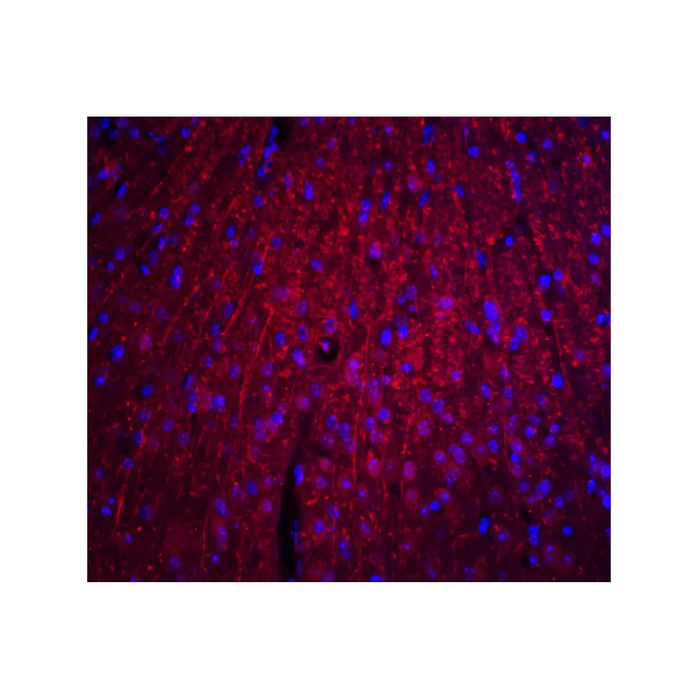 ProSci 8173_S ARID1A Antibody, ProSci, 0.02 mg/Unit Quaternary Image