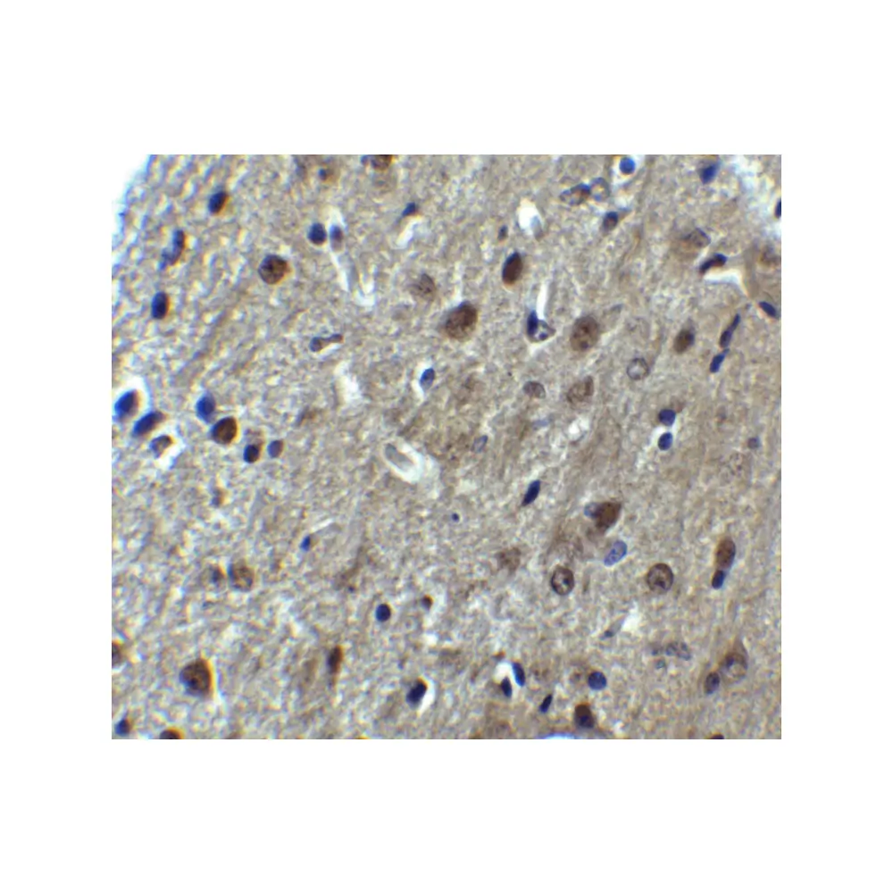 ProSci 8173_S ARID1A Antibody, ProSci, 0.02 mg/Unit Secondary Image