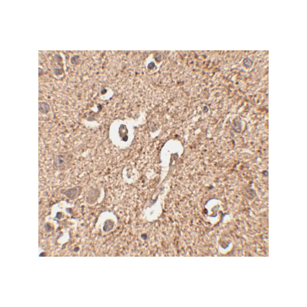 ProSci 4423 ATG12 Antibody, ProSci, 0.1 mg/Unit Secondary Image