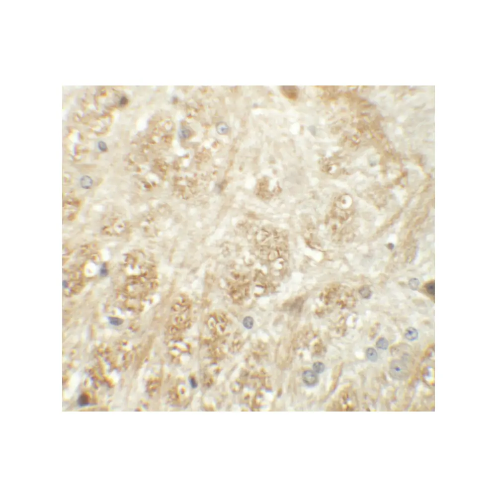 ProSci 6287 ATP2C1 Antibody, ProSci, 0.1 mg/Unit Secondary Image