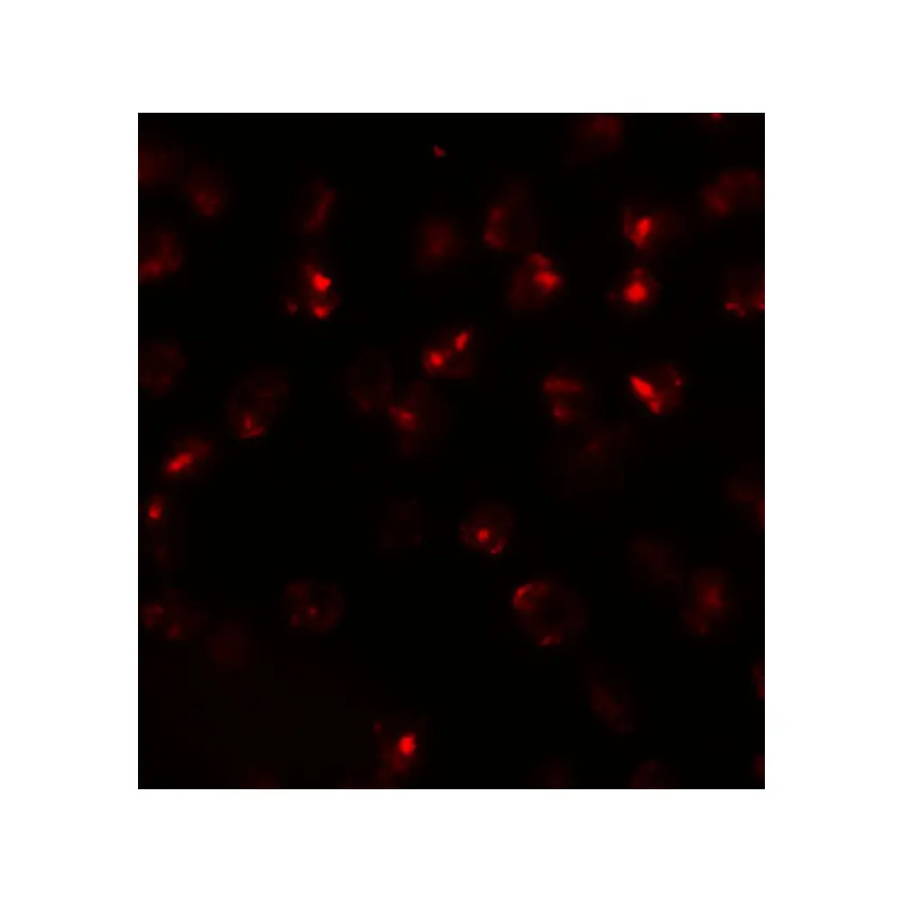 ProSci 6289 ATP2C2 Antibody, ProSci, 0.1 mg/Unit Secondary Image