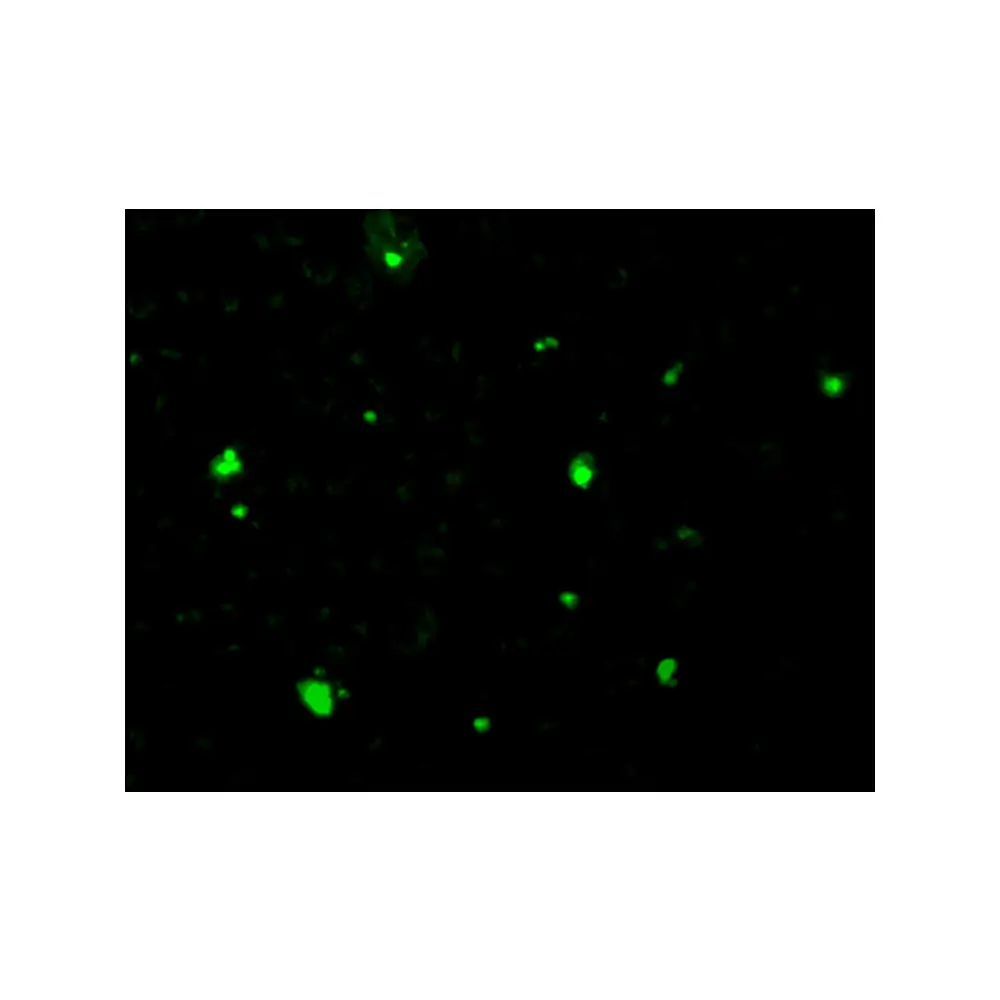 ProSci 2215_S Acinus Antibody, ProSci, 0.02 mg/Unit Tertiary Image