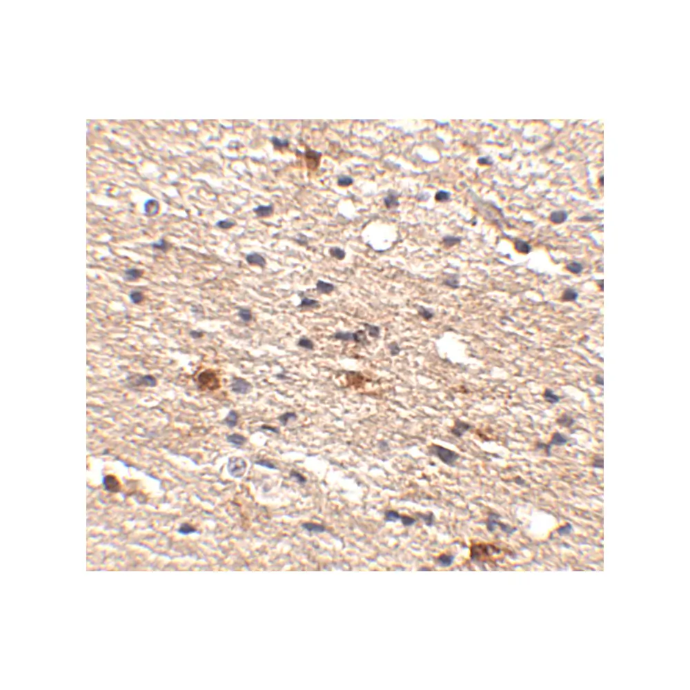 ProSci 4853_S Aipl1 Antibody, ProSci, 0.02 mg/Unit Secondary Image