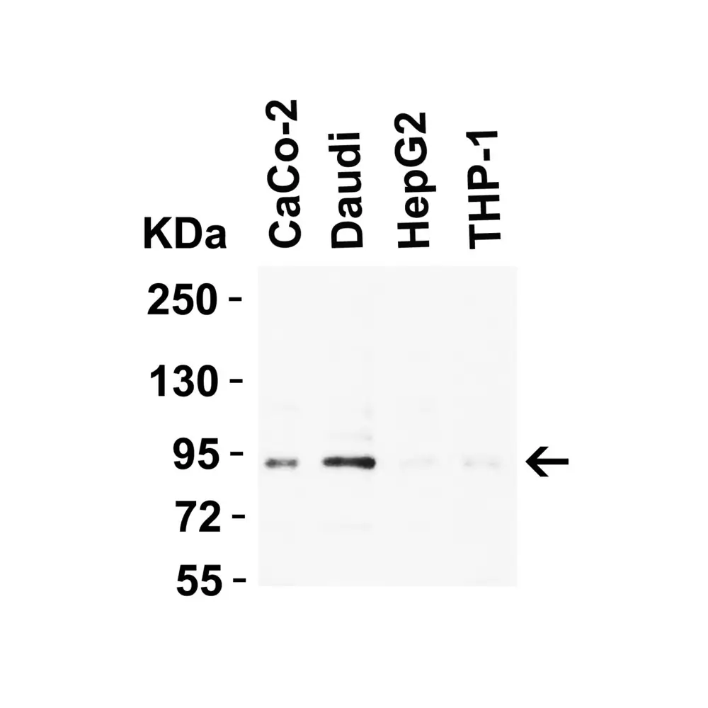 ProSci 5777_S B-raf Antibody, ProSci, 0.02 mg/Unit Tertiary Image