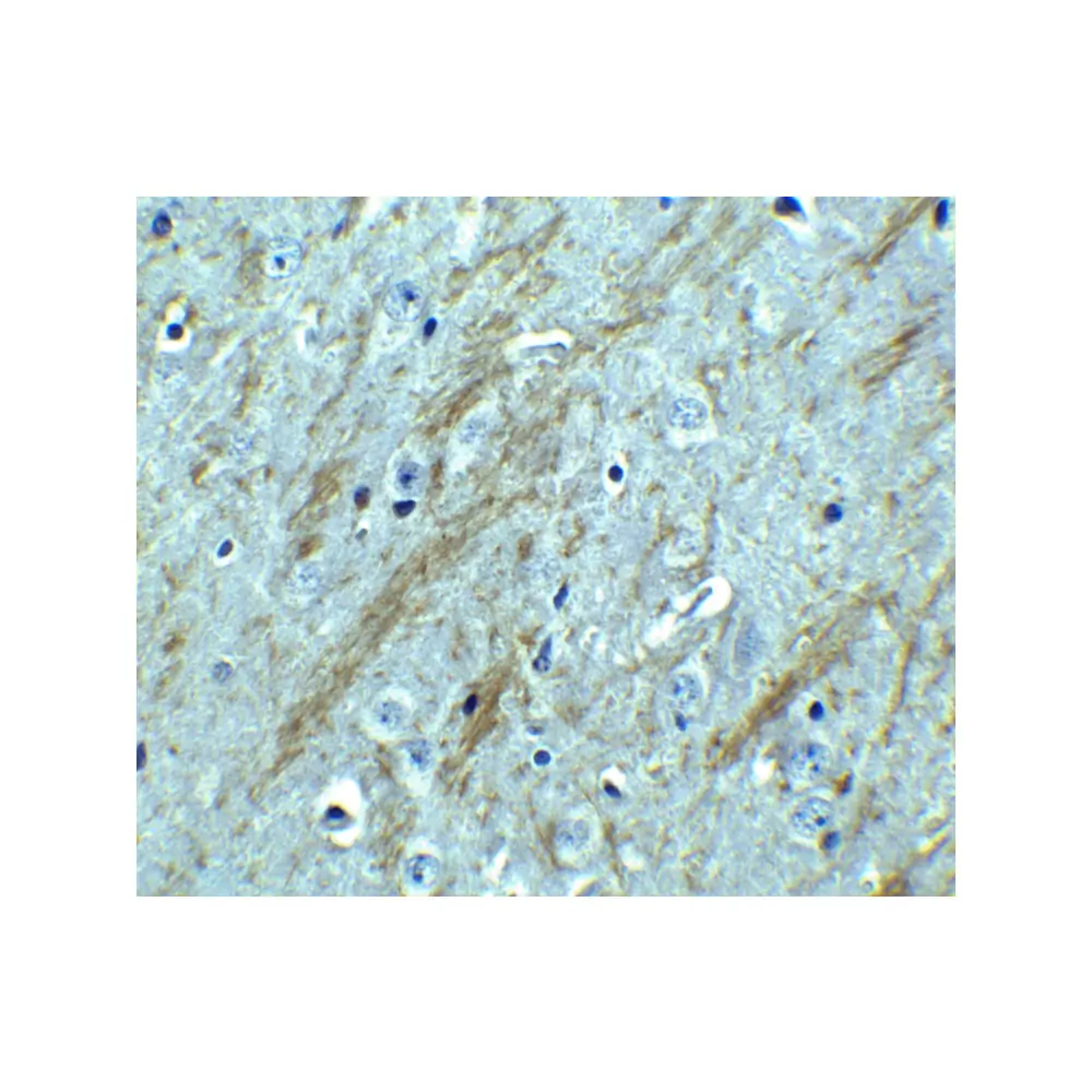 ProSci 2253 BACE Antibody, ProSci, 0.1 mg/Unit Tertiary Image
