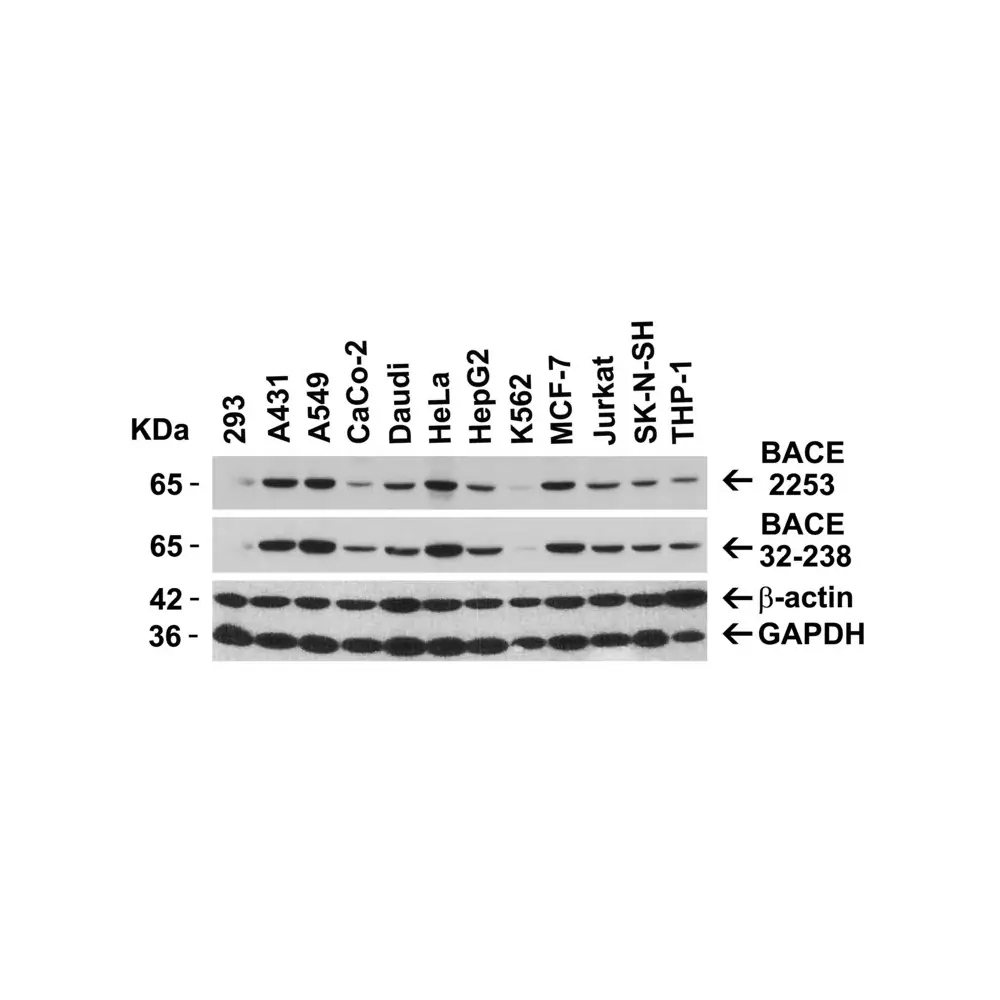 ProSci 2253 BACE Antibody, ProSci, 0.1 mg/Unit Secondary Image