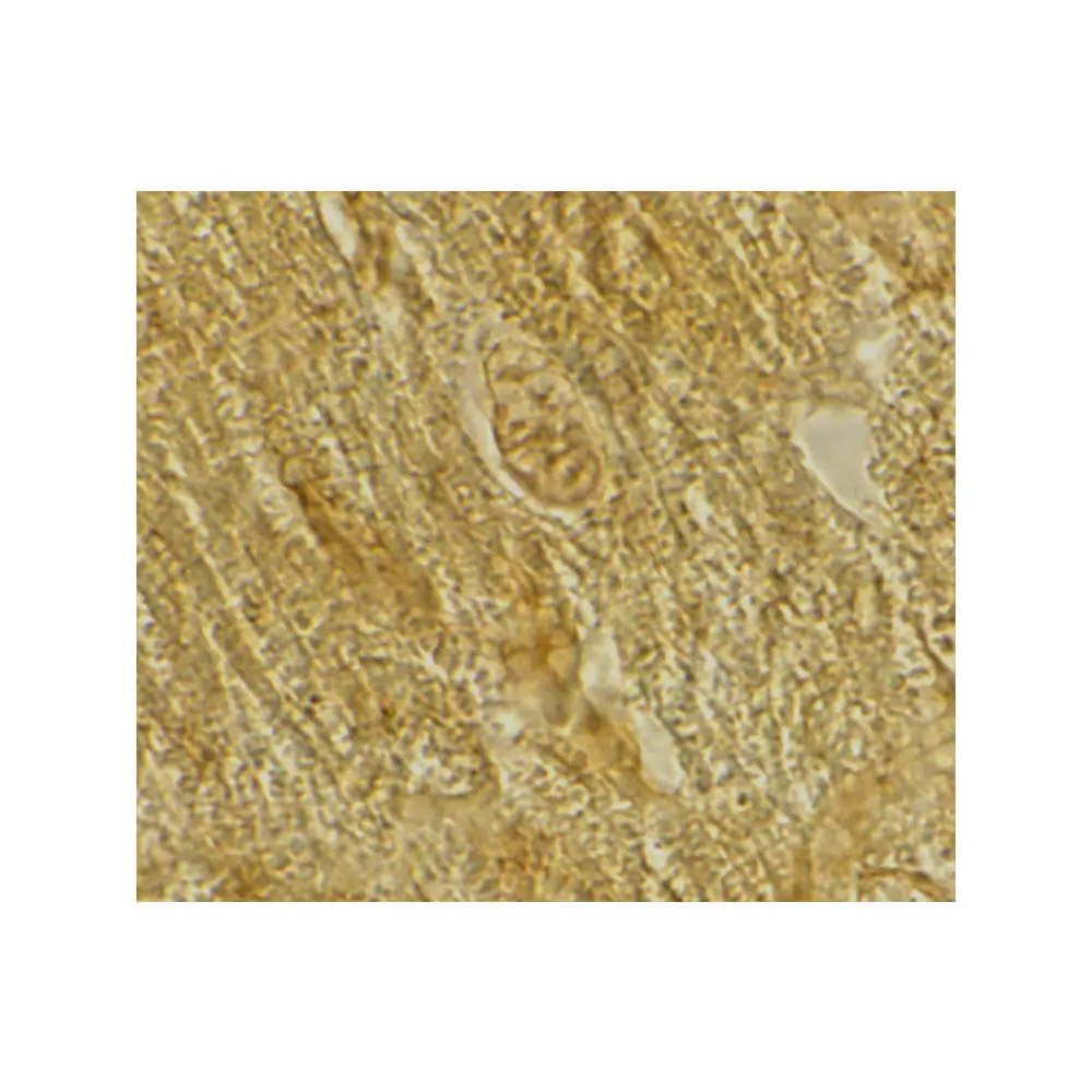 ProSci 2249 BACE2 Antibody, ProSci, 0.1 mg/Unit Secondary Image