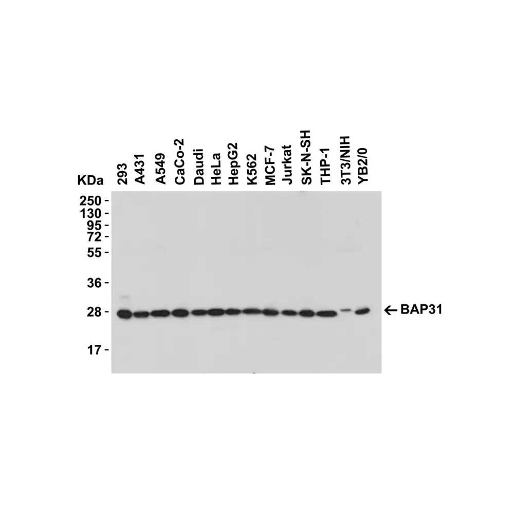 ProSci 3665_S BAP31 Antibody, ProSci, 0.02 mg/Unit Secondary Image