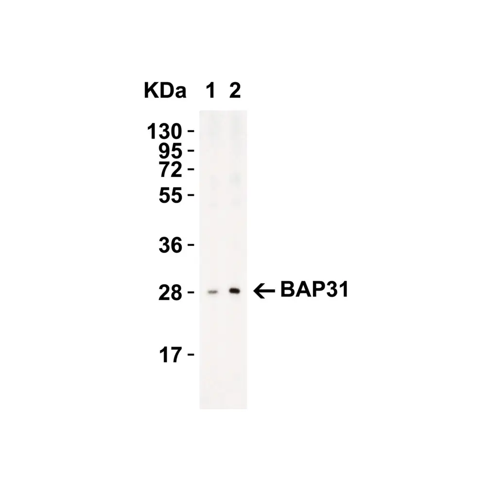 ProSci 3665_S BAP31 Antibody, ProSci, 0.02 mg/Unit Tertiary Image