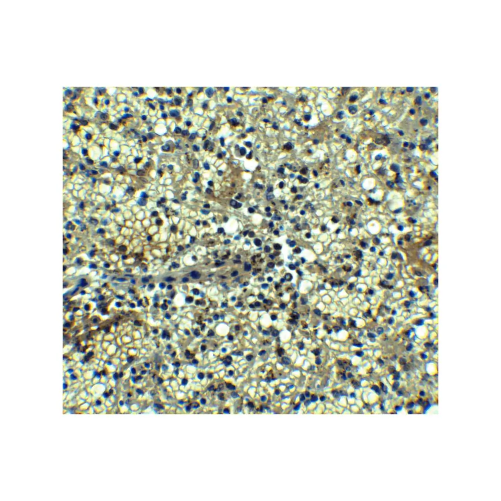 ProSci 2397 BCMA Antibody, ProSci, 0.1 mg/Unit Secondary Image