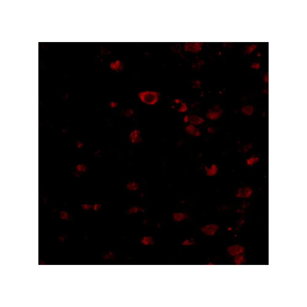 ProSci 4081 BRSK1 Antibody, ProSci, 0.1 mg/Unit Tertiary Image