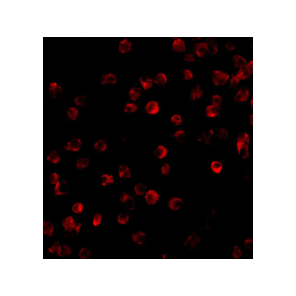 ProSci 3395 BTK Antibody, ProSci, 0.1 mg/Unit Tertiary Image