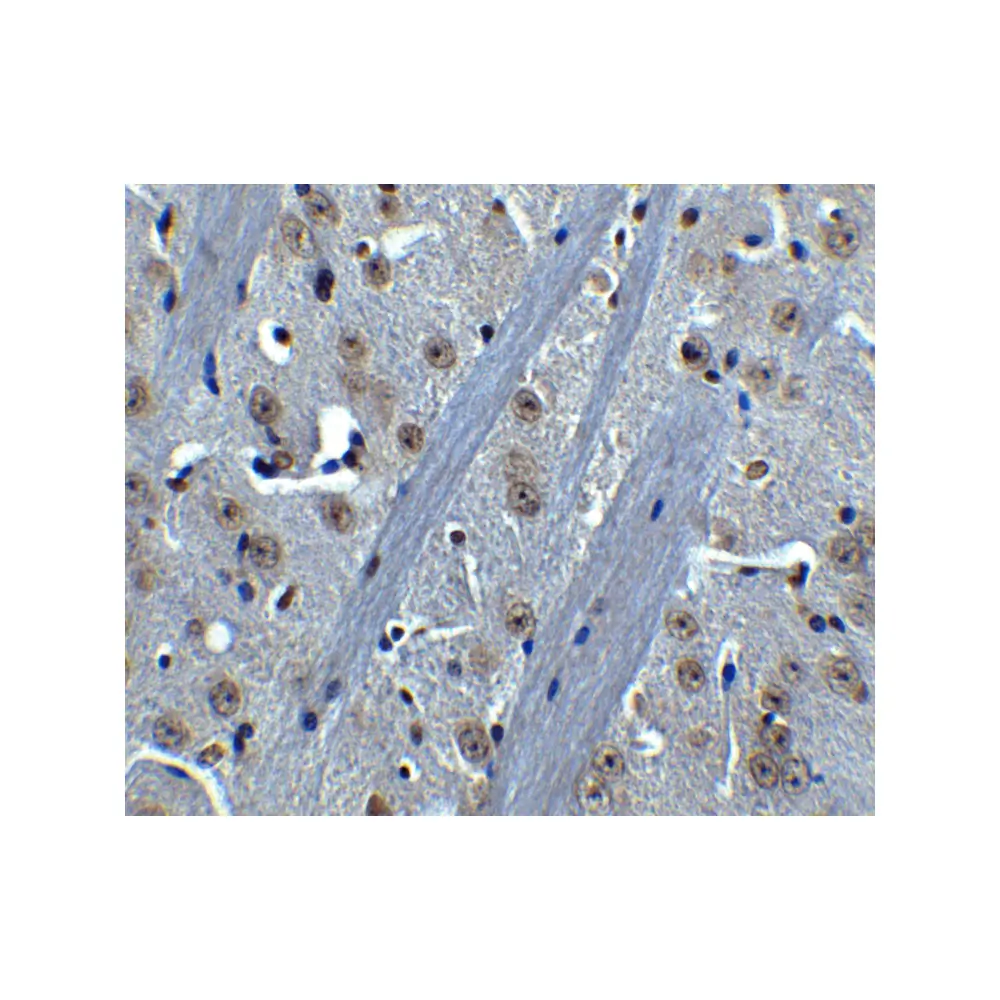 ProSci 3395 BTK Antibody, ProSci, 0.1 mg/Unit Secondary Image
