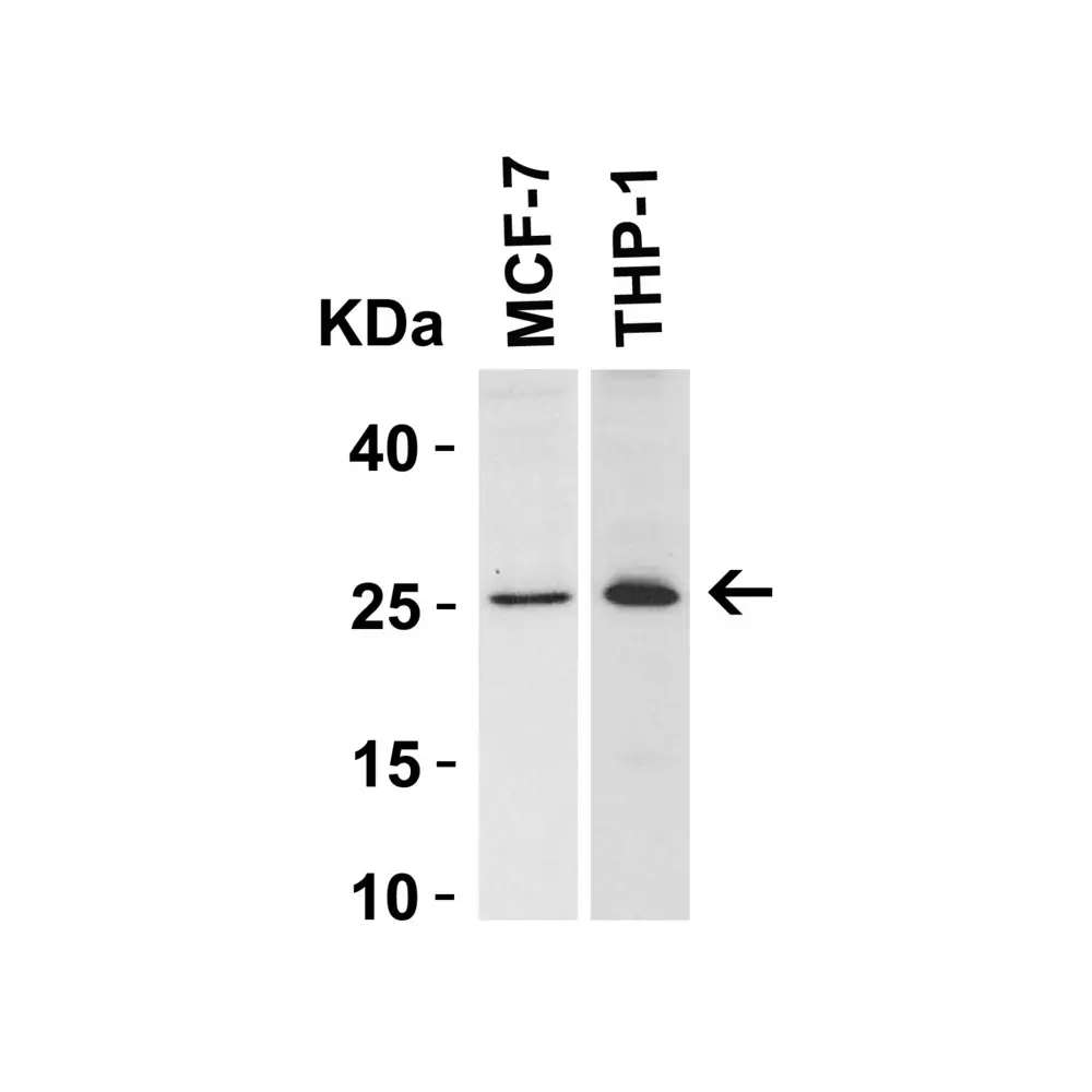 ProSci 3335_S Bcl-2 Antibody, ProSci, 0.02 mg/Unit Tertiary Image