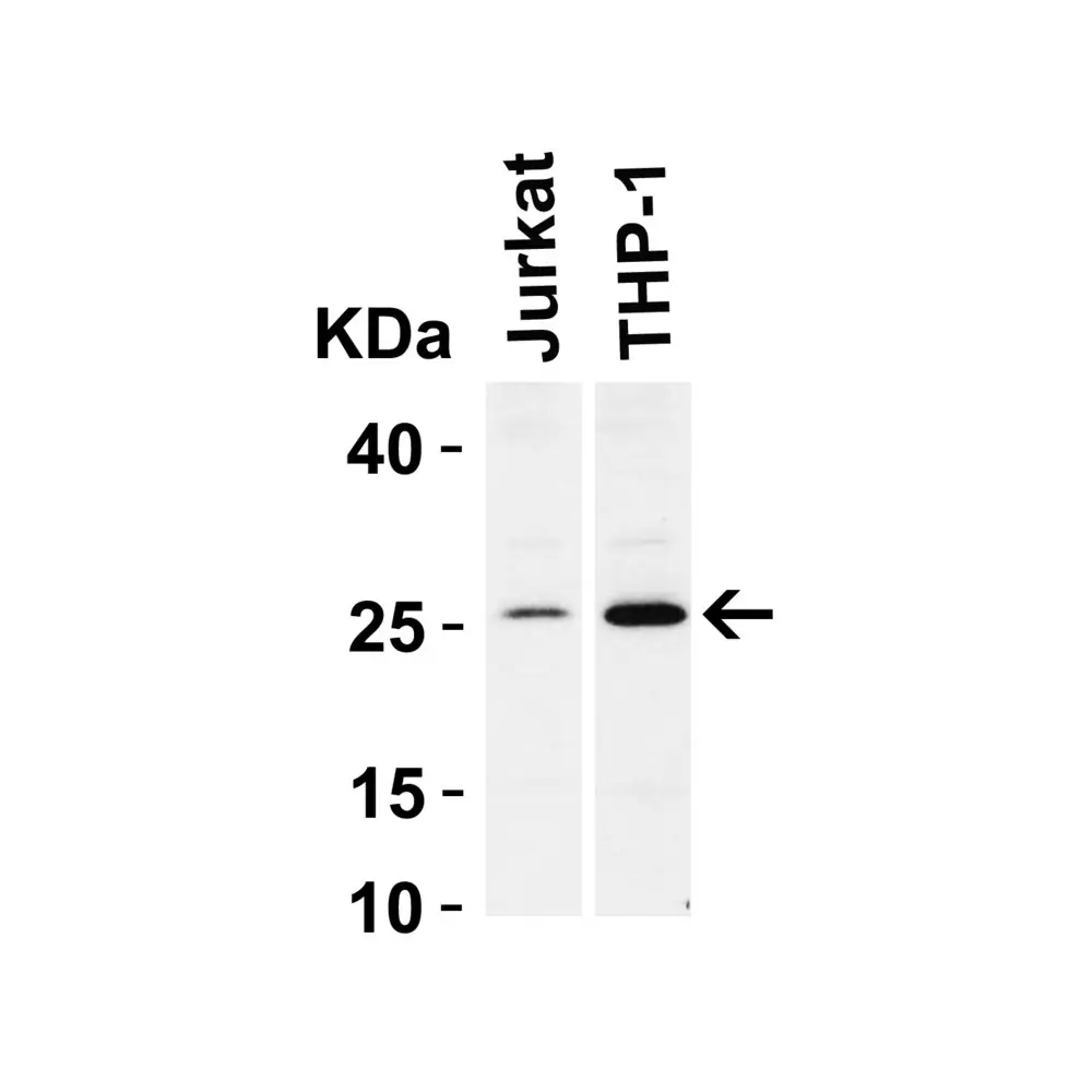 ProSci 3337_S Bcl-2 Antibody, ProSci, 0.02 mg/Unit Tertiary Image