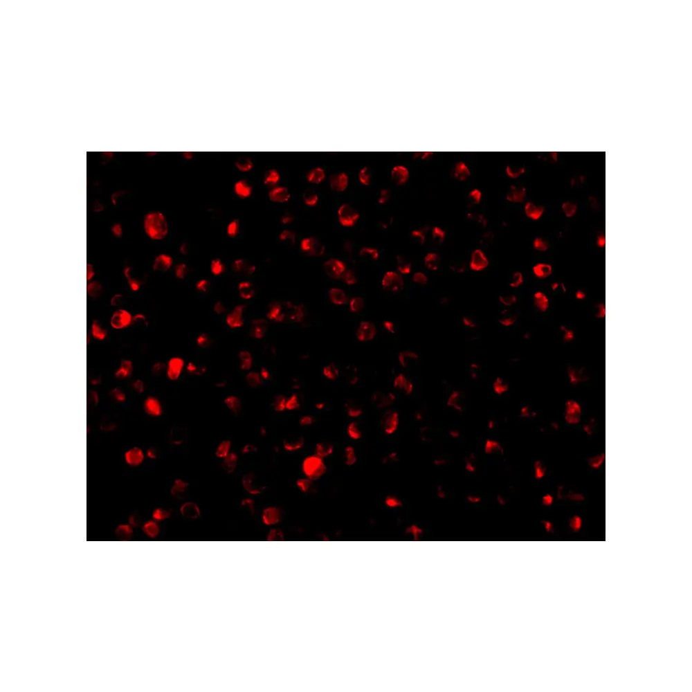 ProSci 3603 Bit1 Antibody, ProSci, 0.1 mg/Unit Tertiary Image