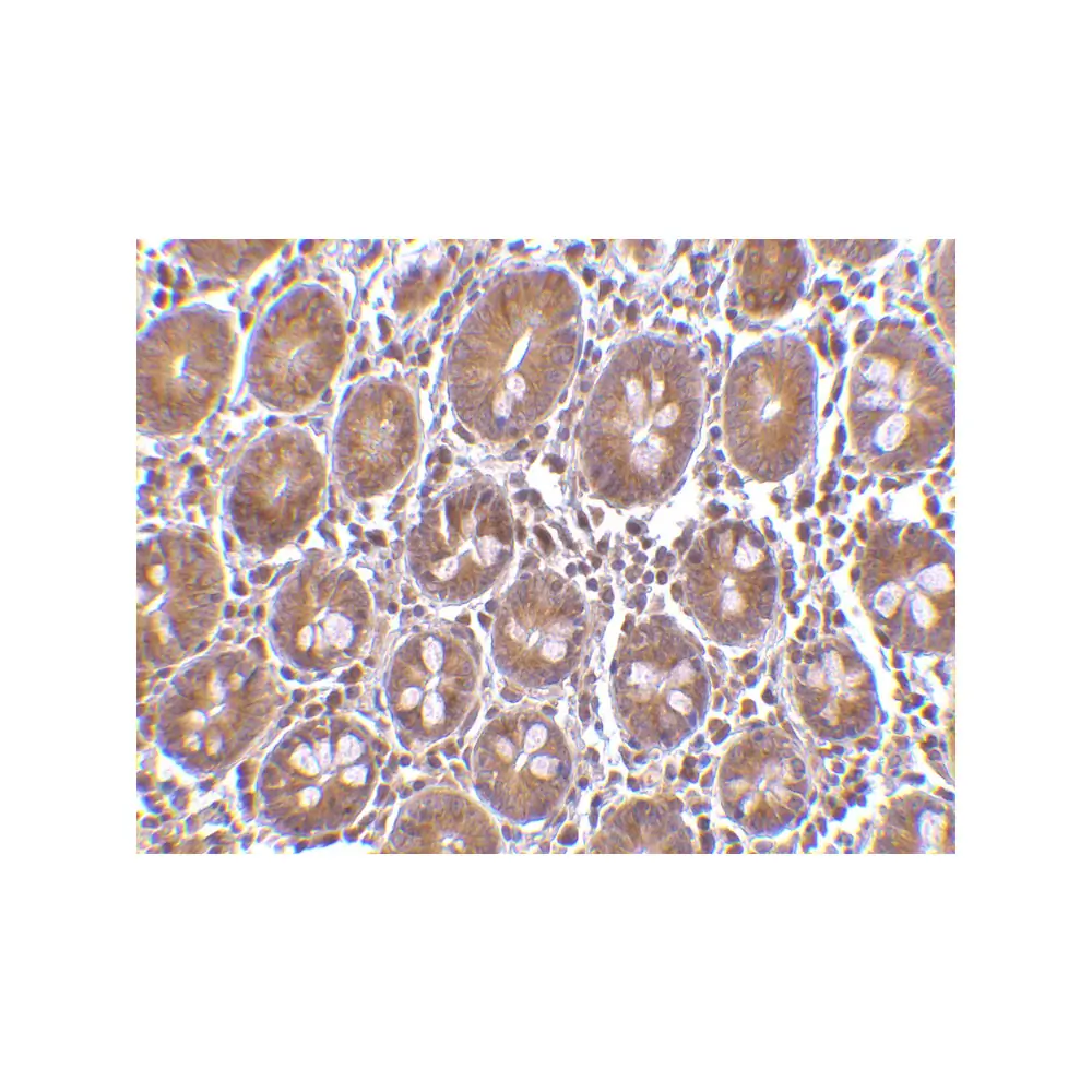 ProSci 3605_S Bit1 Antibody, ProSci, 0.02 mg/Unit Secondary Image