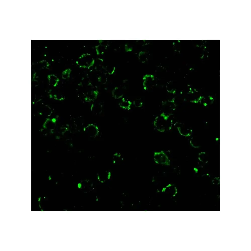 ProSci 3013_S CARD10 Antibody, ProSci, 0.02 mg/Unit Tertiary Image