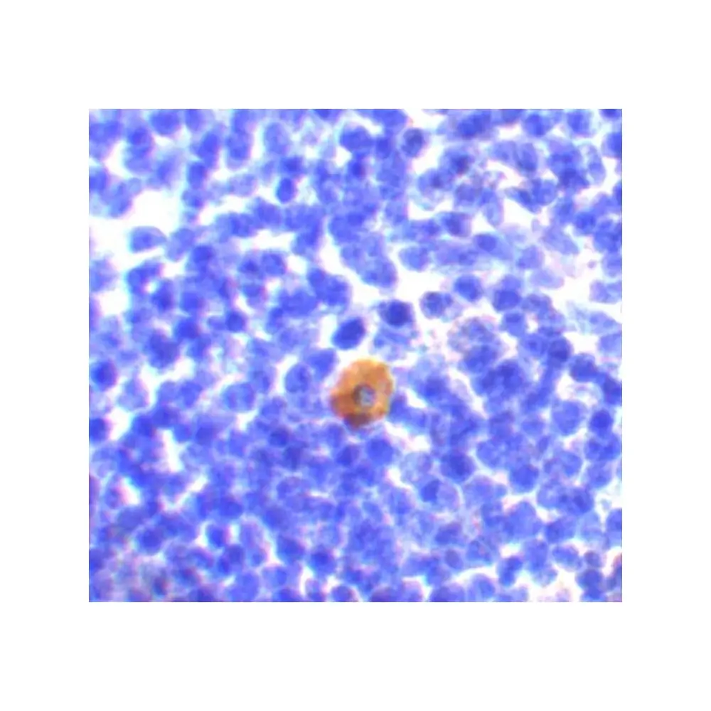 ProSci 3189_S CARMA1 Antibody, ProSci, 0.02 mg/Unit Secondary Image