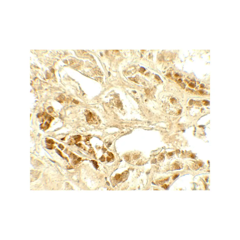 ProSci 7785_S CASR Antibody, ProSci, 0.02 mg/Unit Secondary Image