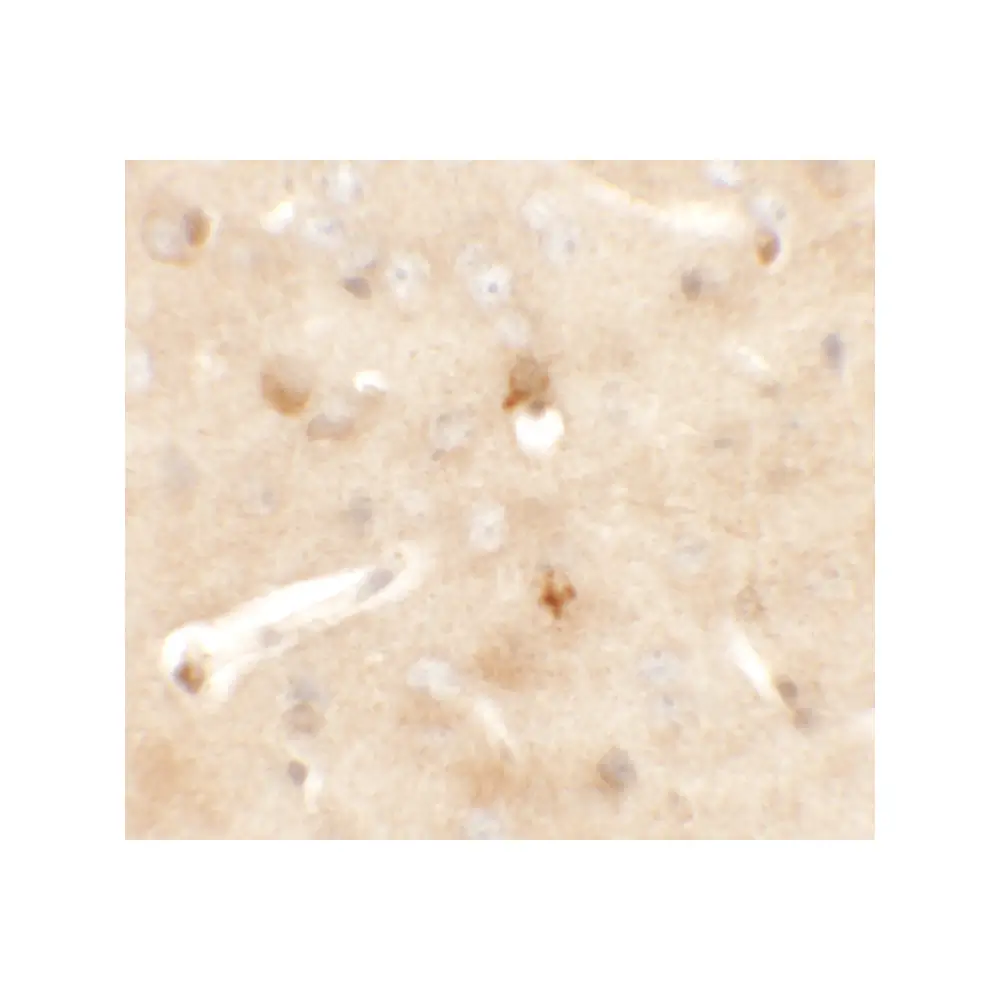 ProSci 6399 CCDC141 Antibody, ProSci, 0.1 mg/Unit Secondary Image