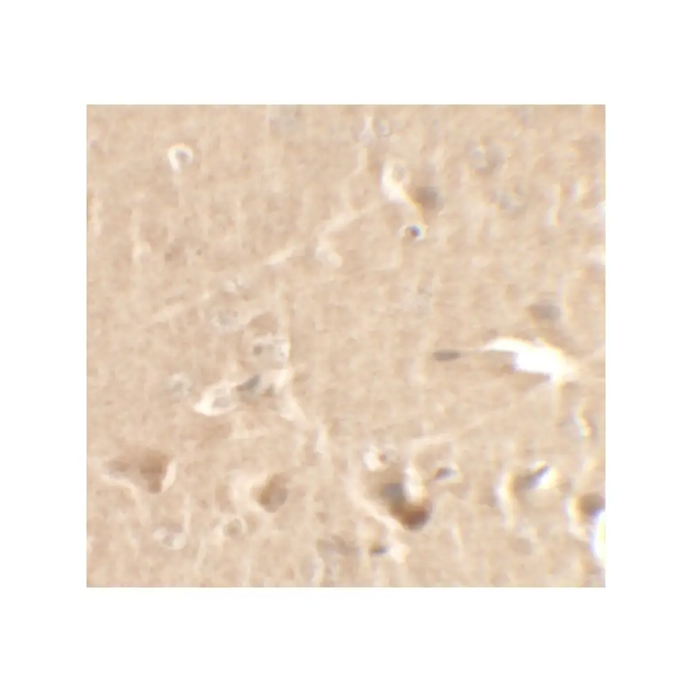 ProSci 7223_S CCNT1 Antibody, ProSci, 0.02 mg/Unit Secondary Image